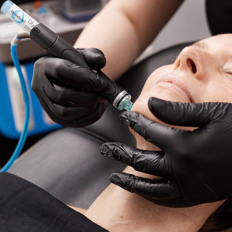 Hydrafacial Treatment Image_ Peel